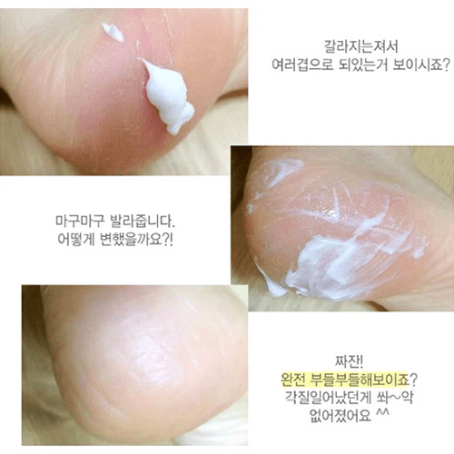 3W Clinic Enrich Foot Treatment – Intensive Foot Cream & Care Treatment (100 ml). - Image 3